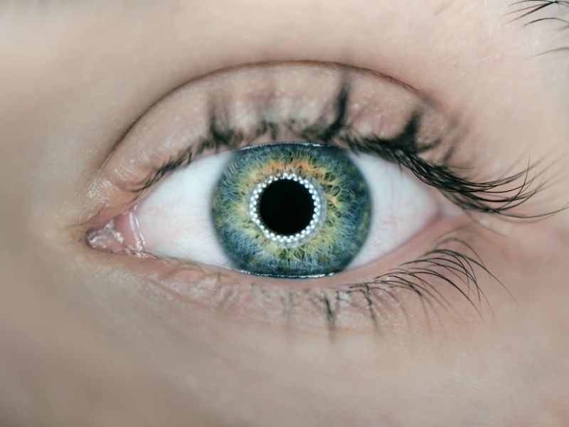 Tomografia de Coerência Óptica (OCT) de disco óptico (Glaucoma)